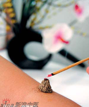 節(jié)氣灸” 冬至，你灸了嗎？