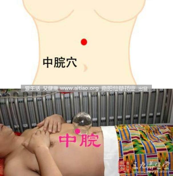 中脘穴位于腹部正中線，臍上4寸的位置上。每天艾灸10-15分鐘，能有效緩解胃部不適的癥狀，同時(shí)有助于祛濕。